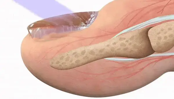 CONCLUSION: MykoMed  Wipes Out Fungus Unlike Anything Else We’ve Seen